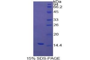 SDS-PAGE analysis of Cow Transthyretin Protein. (TTR 蛋白)