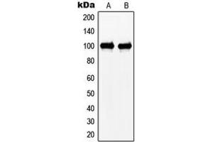 Western blot analysis of N4BP1 expression in HeLa (A), Jurkat (B) whole cell lysates. (N4BP1 抗体  (Center))