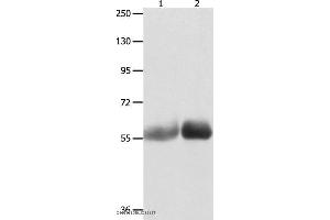 Western blot analysis of Human liver cancer and stomach cancer tissue , using MUTYH Polyclonal Antibody at dilution of 1:1000 (MUTYH 抗体)