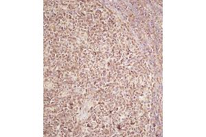 Immunohistochemical analysis of B on paraffin-embedded Human tonsil tissue. (RECQL4 抗体  (C-Term))