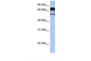 Image no. 1 for anti-Zinc Finger Protein 780B (ZNF780B) (AA 74-123) antibody (ABIN6739279) (ZNF780B 抗体  (AA 74-123))