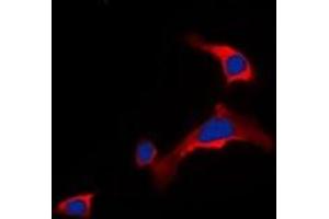 Immunofluorescent analysis of DOK6 staining in COLO205 cells. (DOK6 抗体)