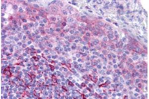Human Tonsil: Formalin-Fixed, Paraffin-Embedded (FFPE) (GPR171 抗体  (Extracellular Domain))