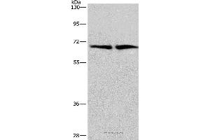 Western blot analysis of Human brain malignant glioma and bladder carcinoma tissue, using CDK5RAP3 Polyclonal Antibody at dilution of 1:449 (CDK5RAP3 抗体)