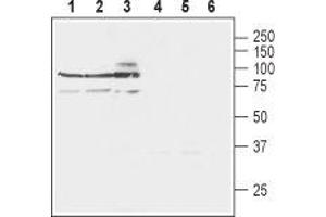 Western blot analysis of rat brain lysates (lanes 1 and 4), mouse brain lysates (lanes 2 and 5) and human SH-SY5Y neuroblastoma cell lysates (lanes 3 and 6): - 1-3. (SLC8A3 抗体  (3rd Intracellular Loop))