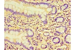 Immunohistochemistry of paraffin-embedded human small intestine tissue using ABIN7157760 at dilution of 1:100 (CCBL1 抗体  (AA 1-372))