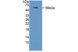 Detection of Recombinant APOL1, Human using Polyclonal Antibody to Apolipoprotein L (APOL1) (APOL1 抗体  (AA 1-238))
