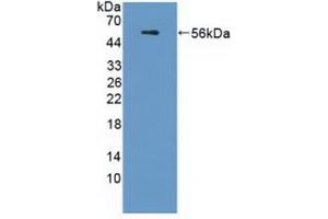 Detection of Recombinant APOL1, Human using Polyclonal Antibody to Apolipoprotein L (APOL1) (APOL1 抗体  (AA 1-238))
