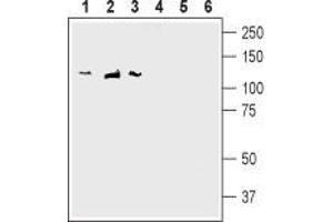 Western blot analysis of rat brain membranes (lanes 1 and 4), mouse brain membranes (lanes 2 and 5) and human SH-SY5Y neuroblastoma cell line lysate (lanes 3 and 6): - 1-3. (DLG1 抗体  (L27 Domain, N-Term))