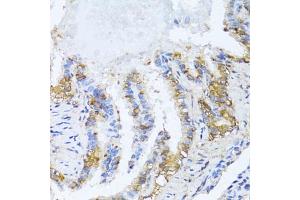 Immunohistochemistry of paraffin-embedded rat lung using N antibody (ABIN6132387, ABIN6144378, ABIN6144379 and ABIN6216511) at dilution of 1:100 (40x lens). (NAT2 抗体  (AA 171-290))