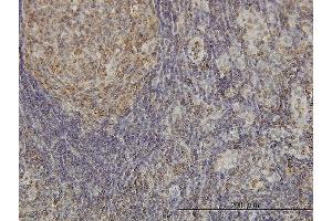 Immunoperoxidase of monoclonal antibody to CDKL4 on formalin-fixed paraffin-embedded human lymph node. (CDKL4 抗体  (AA 196-295))