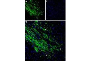 Immunohistochemistry (IHC) image for anti-Potassium Inwardly-Rectifying Channel, Subfamily J, Member 6 (KCNJ6) (AA 374-414), (Intracellular) antibody (ABIN7043487)