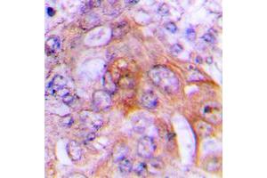 Immunohistochemical analysis of HADH2 staining in human lung formalin fixed paraffin embedded tissue section. (HSD17B10 抗体  (Center))
