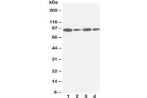Western blot testing of FES antibody and Lane 1:  HeLa;  2: 293T;  3: SKOV;  4: A549 lysate.