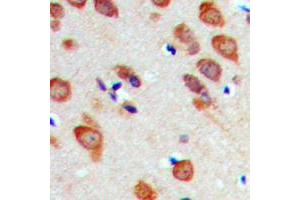 Immunohistochemical analysis of RPL22 staining in human brain formalin fixed paraffin embedded tissue section. (RPL22 抗体  (Center))