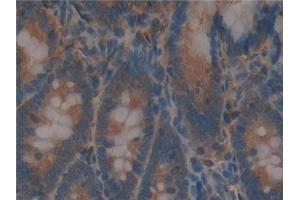 Detection of BFP in Rat Intestine Tissue using Polyclonal Antibody to Brain Finger Protein (BFP) (RNF112 抗体  (AA 256-504))