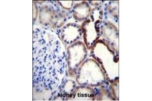 Immunohistochemistry (Paraffin-embedded Sections) (IHC (p)) image for anti-Naked Cuticle Homolog 2 (NKD2) (AA 366-393), (C-Term) antibody (ABIN656092)