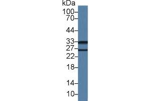 Western Blot; Sample: Mouse Lung lysate; Primary Ab: 1µg/ml Rabbit Anti-Mouse LDLRAP1 Antibody Second Ab: 0. (LDLRAP1 抗体  (AA 1-308))