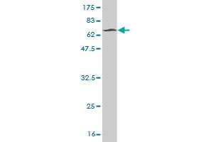 Western Blot detection against Immunogen (66. (STK32C 抗体  (AA 1-369))