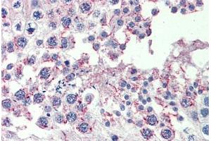 Testis, Human: Formalin-Fixed, Paraffin-Embedded (FFPE) (CPXCR1 抗体  (AA 396-445))