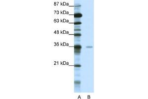 WB Suggested Anti-MBD2 Antibody Titration:  0. (MBD2 抗体  (Middle Region))