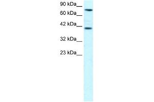 WB Suggested Anti-ZNF652 Antibody Titration: 0.