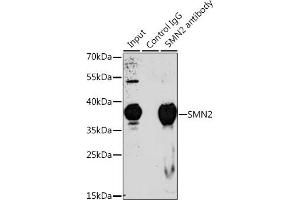 Immunoprecipitation analysis of 200 μg extracts of 293T cells, using 3 μg SMN2 antibody (ABIN6127949, ABIN6148136, ABIN6148139 and ABIN6218739). (SMN2 抗体  (AA 1-197))