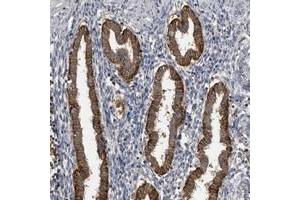Immunohistochemical staining of human corpus, uterine with CMTM6 polyclonal antibody  strong cytoplasmic positivity in glandular cells. (CMTM6 抗体)