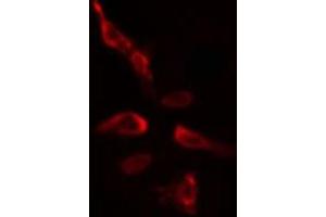 ABIN6275395 staining  HeLa cells by IF/ICC. (SLU7 抗体  (Internal Region))