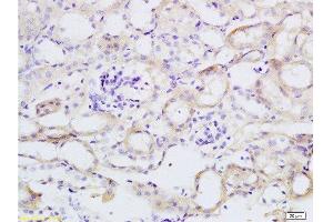 Formalin-fixed and paraffin embedded mouse kidney tissue labeled with Anti-TNFSF18 Polyclonal Antibody, Unconjugated  at 1:200 followed by conjugation to the secondary antibody and DAB staining (TNFSF18 抗体  (AA 101-199))