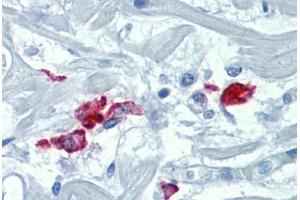 Heart, Human: Formalin-Fixed, Paraffin-Embedded (FFPE) (DC-SIGN/CD209 抗体)