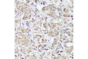 Immunohistochemistry (IHC) image for anti-Methylenetetrahydrofolate Dehydrogenase (NADP+ Dependent) 2, Methenyltetrahydrofolate Cyclohydrolase (MTHFD2) (AA 40-250) antibody (ABIN6144144)