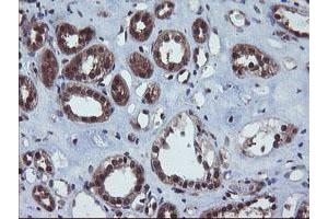 Image no. 4 for anti-Prefoldin Subunit 3 (PFDN3) antibody (ABIN1501707)