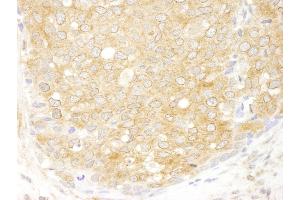 anti-eIF2beta/EIF2S2 (AA 283-333) antibody