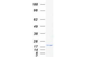 Western Blotting (WB) image for Interleukin 1 delta (FIL1d) (Transcript Variant 1) protein (Myc-DYKDDDDK Tag) (ABIN2723373)