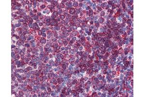 Anti-SC5DL antibody IHC of human tonsil. (SC5DL 抗体  (AA 71-120))