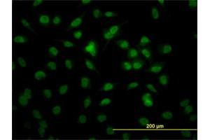 Immunofluorescence of monoclonal antibody to RBBP4 on HeLa cell.