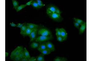 Immunofluorescence staining of HepG2 cells with ABIN7176651 at 1:100, counter-stained with DAPI. (ZFR 抗体  (AA 150-268))