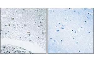 Immunohistochemistry analysis of paraffin-embedded human brain tissue, using LAMC3 Antibody. (LAMC3 抗体  (AA 1361-1410))