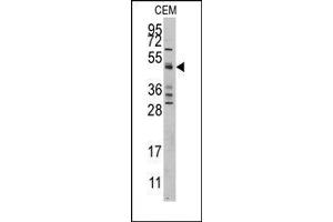 Image no. 1 for anti-Caspase 9, Apoptosis-Related Cysteine Peptidase (CASP9) (Middle Region) antibody (ABIN360397) (Caspase 9 抗体  (Middle Region))