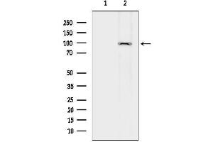 Western blot analysis of lysates from Hela cells(heat-shock treatment), using SEMD Antibody.