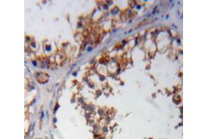 Used in DAB staining on fromalin fixed paraffin-embedded testis tissue (WNK1 抗体  (AA 1954-2231))