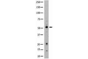 Image no. 1 for anti-Hemopoietic Cell Kinase (HCK) (N-Term) antibody (ABIN359984) (HCK 抗体  (N-Term))