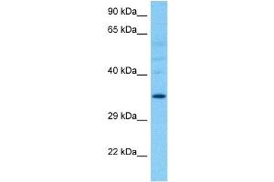 Host:  Rat  Target Name:  HSD11B1  Sample Tissue:  Rat Liver  Antibody Dilution:  1ug/ml