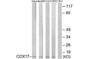 Immunohistochemistry analysis of paraffin-embedded human liver carcinoma tissue using COX17 antibody. (COX17 抗体)