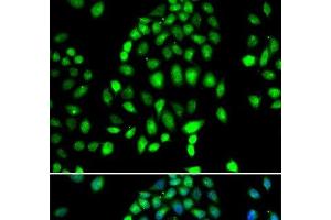 Immunofluorescence analysis of MCF-7 cells using PARP3 Polyclonal Antibody (PARP3 抗体)