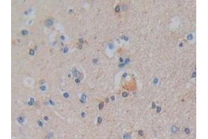 Immunohistochemistry (IHC) image for anti-Prostaglandin E Synthase 2 (PTGES2) (AA 145-357) antibody (ABIN7442885)