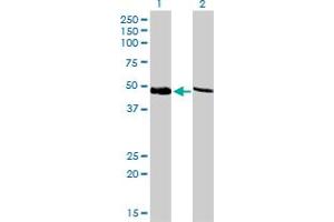 Western Blot analysis of PSMC4 expression in transfected 293T cell line by PSMC4 monoclonal antibody (M01), clone 3G8. (PSMC4 抗体  (AA 1-418))