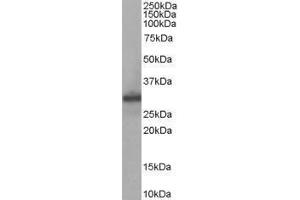 Western Blotting (WB) image for anti-Four and A Half LIM Domains 1 (FHL1) antibody (ABIN2473617) (FHL1 抗体)