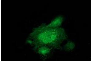 Anti-MAPRE2 mouse monoclonal antibody (ABIN2454497) immunofluorescent staining of COS7 cells transiently transfected by pCMV6-ENTRY MAPRE2 (RC200259). (MAPRE2 抗体)